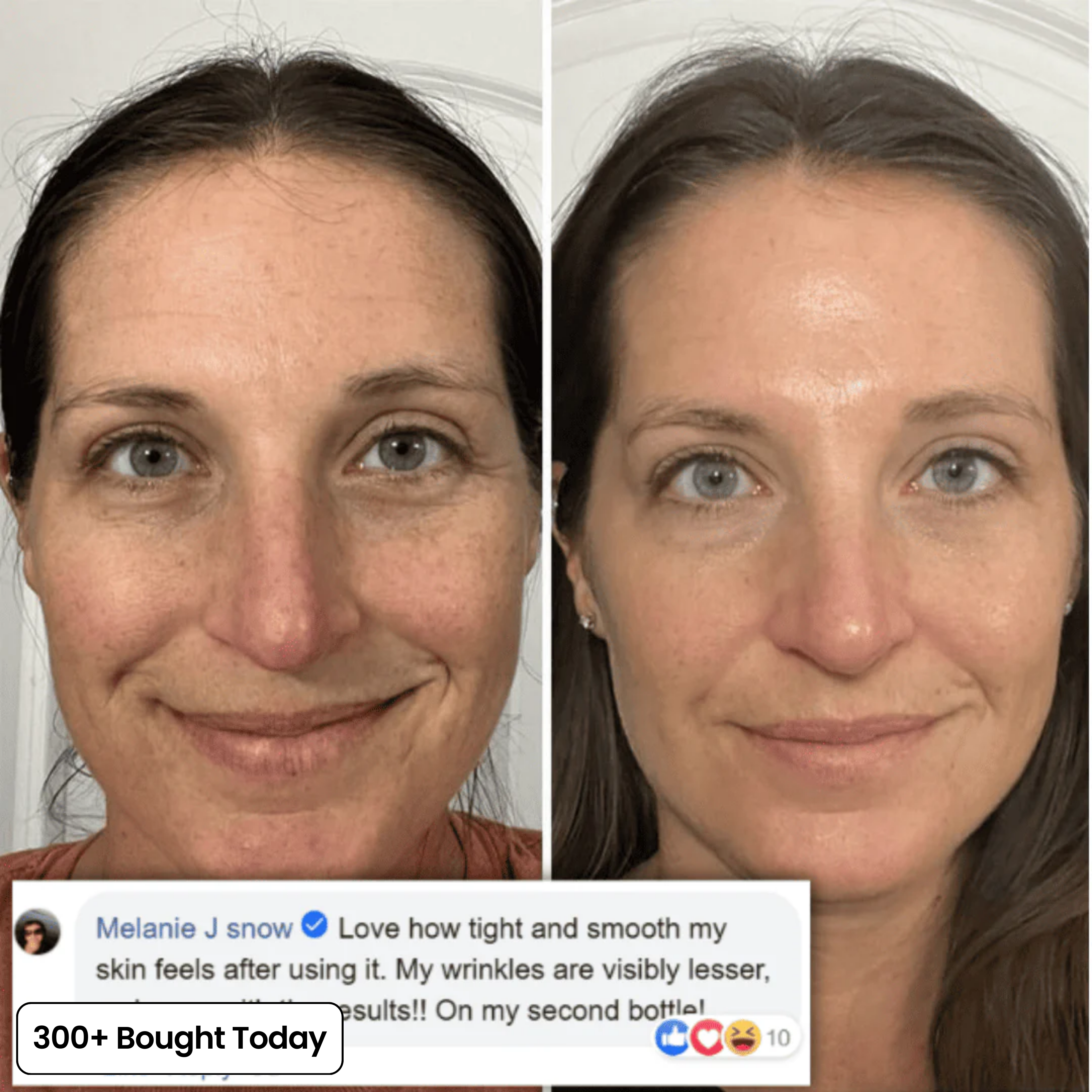 Transform Wrinkles, Fine Lines, And Tired Creases, Naturally!